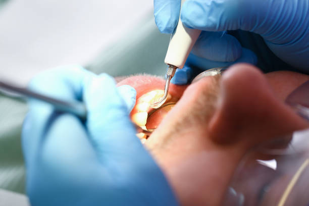 Best Knocked-Out Tooth Emergency  in Bally, PA