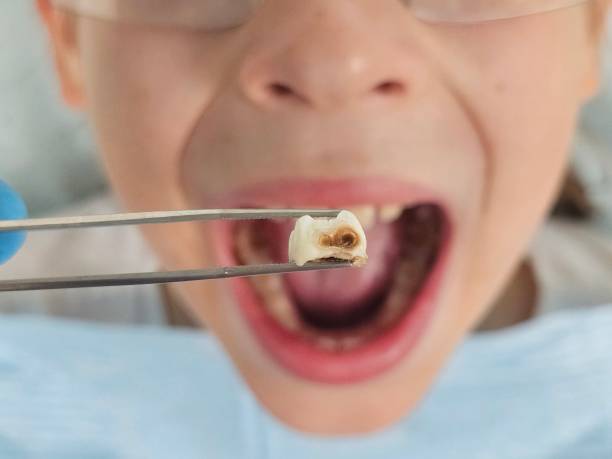 Best Urgent Tooth Repair  in Bally, PA